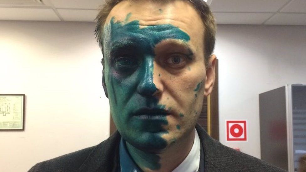 Quiz: Alexei Navalny Was Just Transferred to A Prison Hospital! What Colour Do You Think His Body Is Now?
